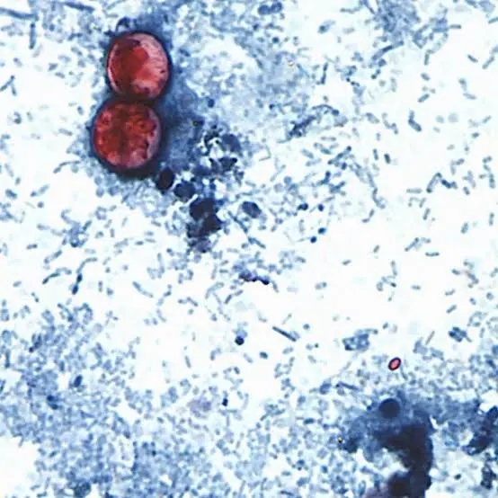 Reportan las primeras dos muertes por brote de ciclosporiasis en Estados Unidos